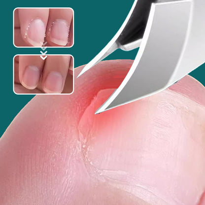💅❄️ "SLUTT PÅ NEGLEKATATROFER! ✂️🛡️ Antislakk 3-delers sett med ergonomisk grep – Designet for svenske vinterfingre" 🌨️🧤