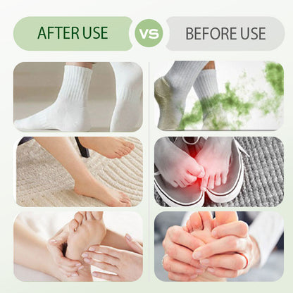 🌿 Jumbo Pack - Botanisk fotvård 🌿 ✨ Dubbla effekter: deodoriserande + antibakteriell 🦶 Designad för fotkomfort och hygien 💦Huvudingredienser: ✅ Naturligt artemisiaextrakt ✅ Tea Tree Oil ✅ Mentol har en kylande effekt