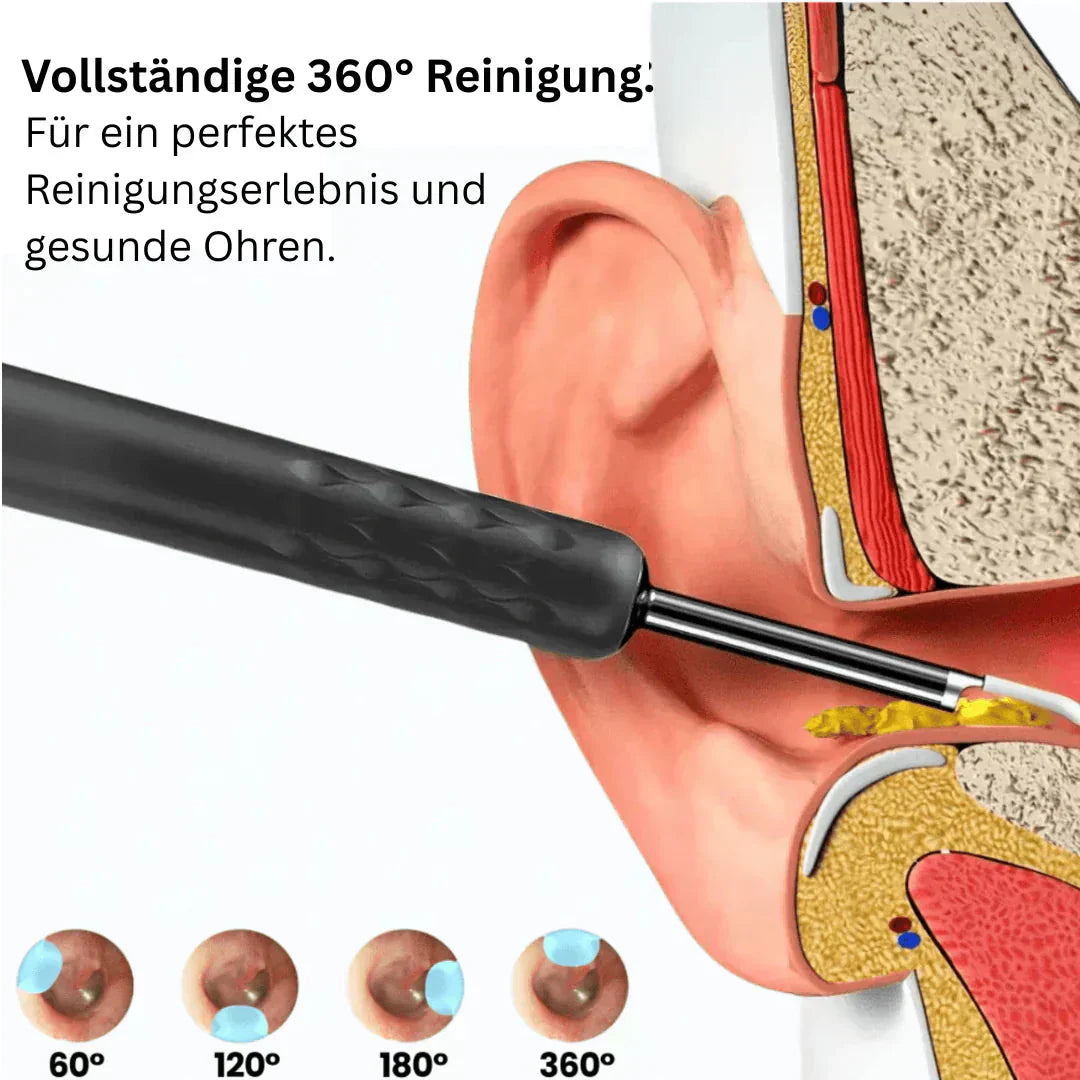 👂✨ SLUT PÅ ÖRONVAXPROBLEM! 2025 års SMART ÖRONVAXBORTTAGARE Vattentät & Visuell – Säker & Effektiv! 💦🔍