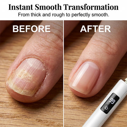 💎 50 % RABATT UNDER BEGRÄNSAD TID! ✨Professionell elektrisk nagelfil
